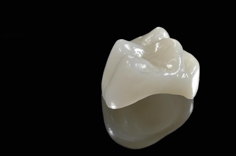Porcelain Crowns  Schererville, IN, 